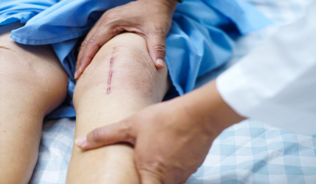 Kirurg s pacijentom koji ima vidljiv veliki operativni ožiljak na prednjoj strani koljena.