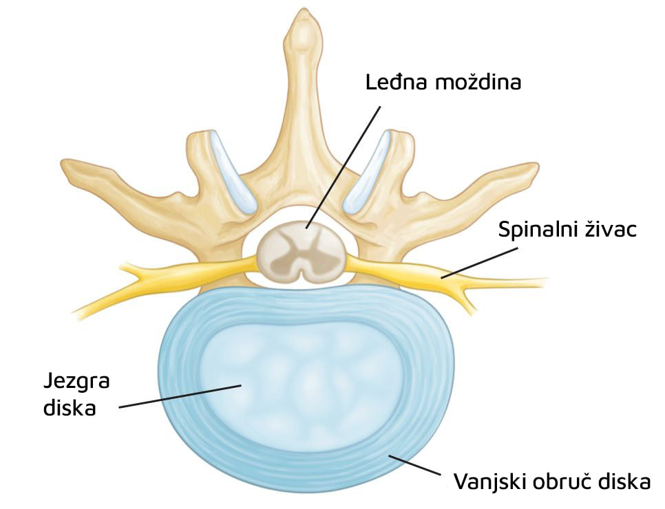 Anatomski prikaz intervertebralnog diska: vanjski prsten i meka želatinozna unutrašnjost.