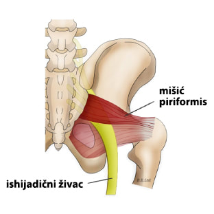 anatomski prikaz mišića piriformisa i ishijadičnog živca
