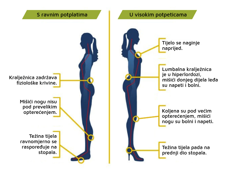 Grafički prikaz koji uspoređuje tijelo u ravnim cipelama i potpeticama