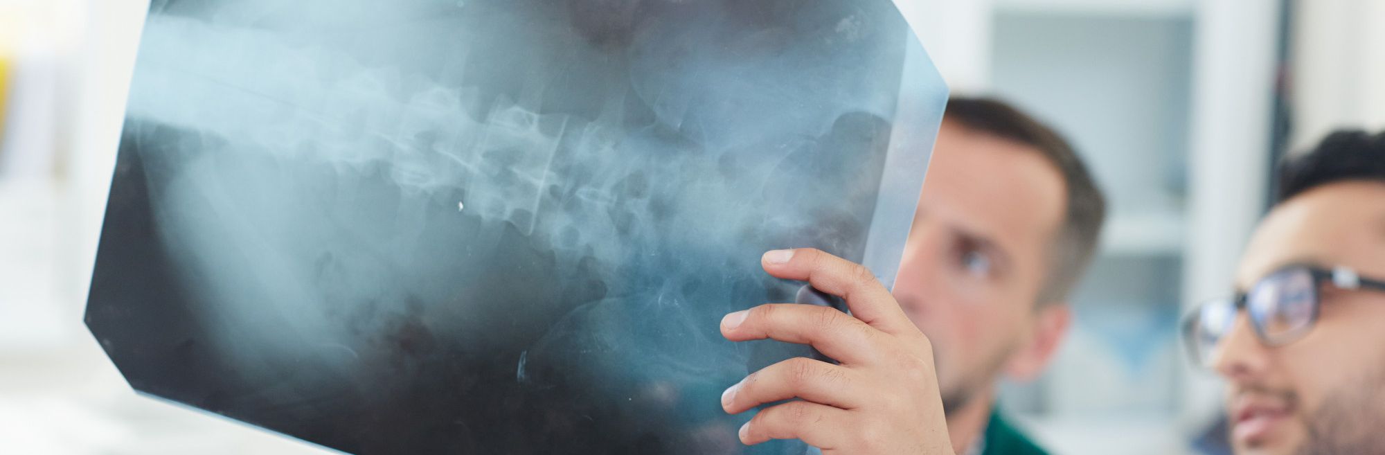 liječnik radiolog drži u ruci rendgen snimku kralježnice